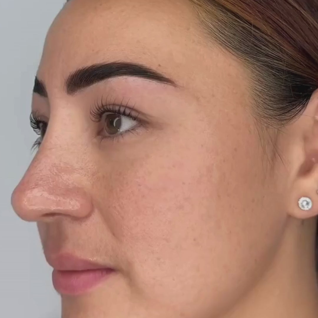 Universal Lash Lifting Shields | Alba