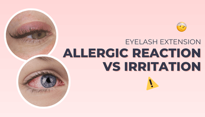 Eyelash Extensions Allergic Reaction vs. Irritation